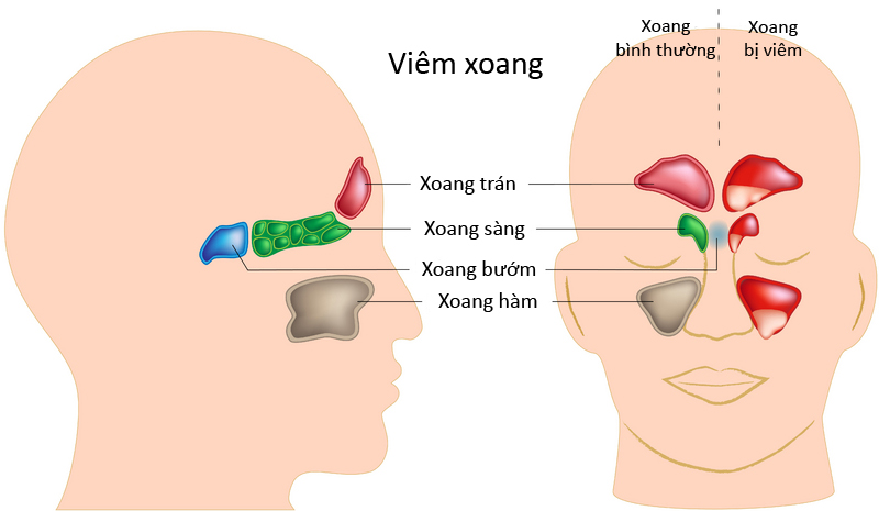 Cơ chế hoạt động của niêm mạc mũi và sự hình thành viêm xoang